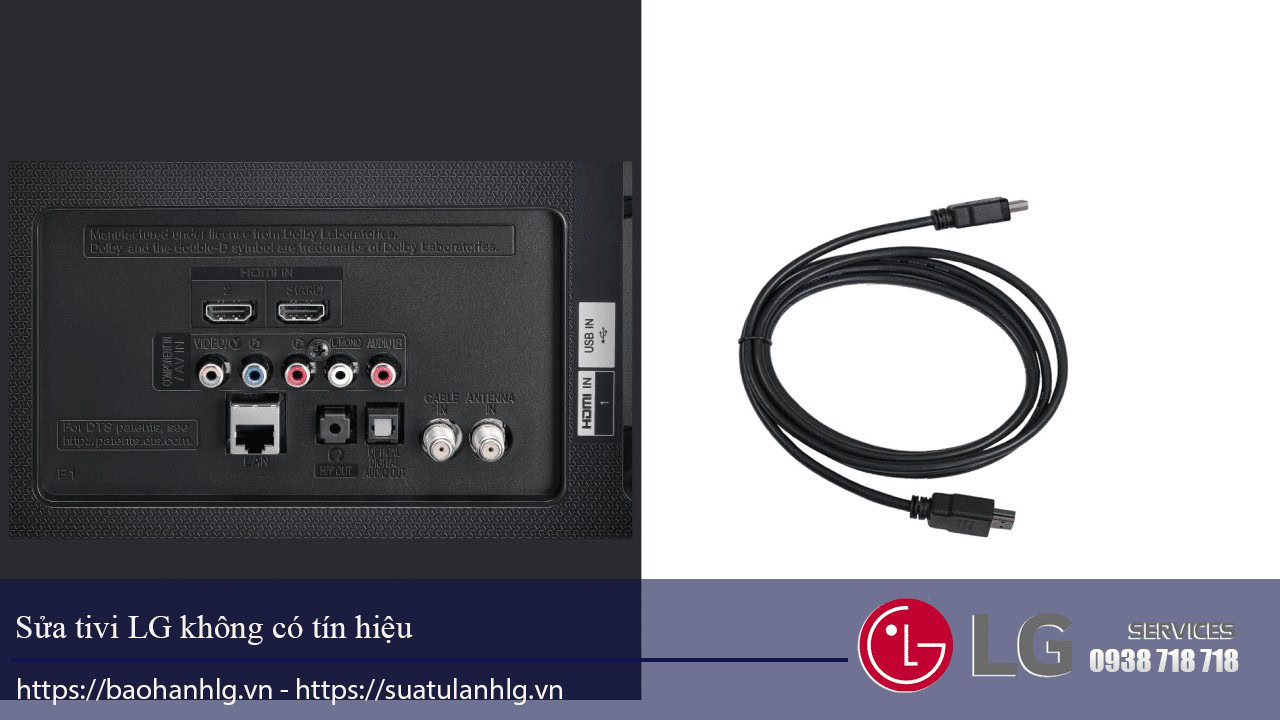 tivi LG không có tín hiệu